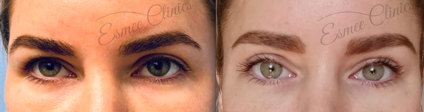Before and After img